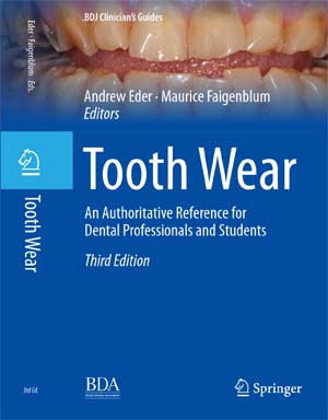 Ordering Tooth Wear book